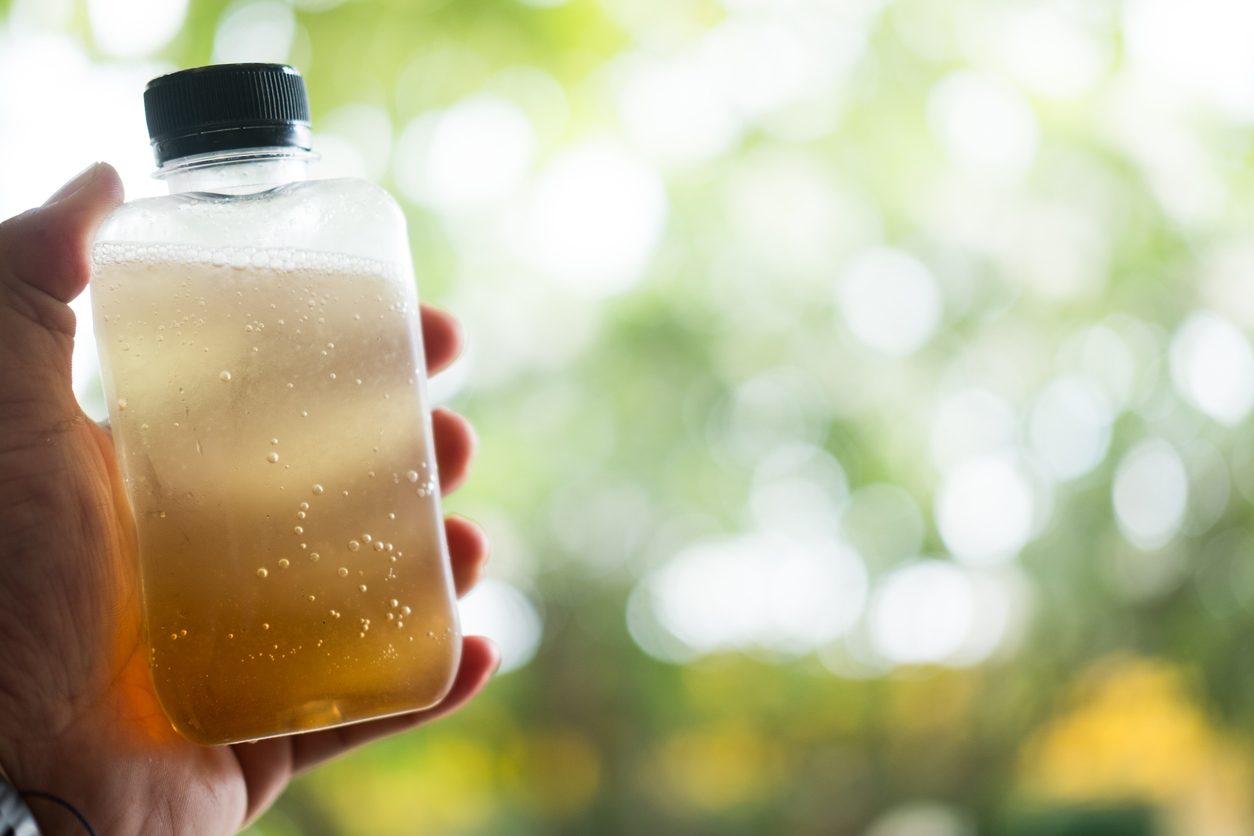 Refreshing bottle filled with fresh lemons and a honey against nature background